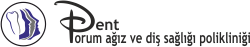 Zahnimplantat Profis